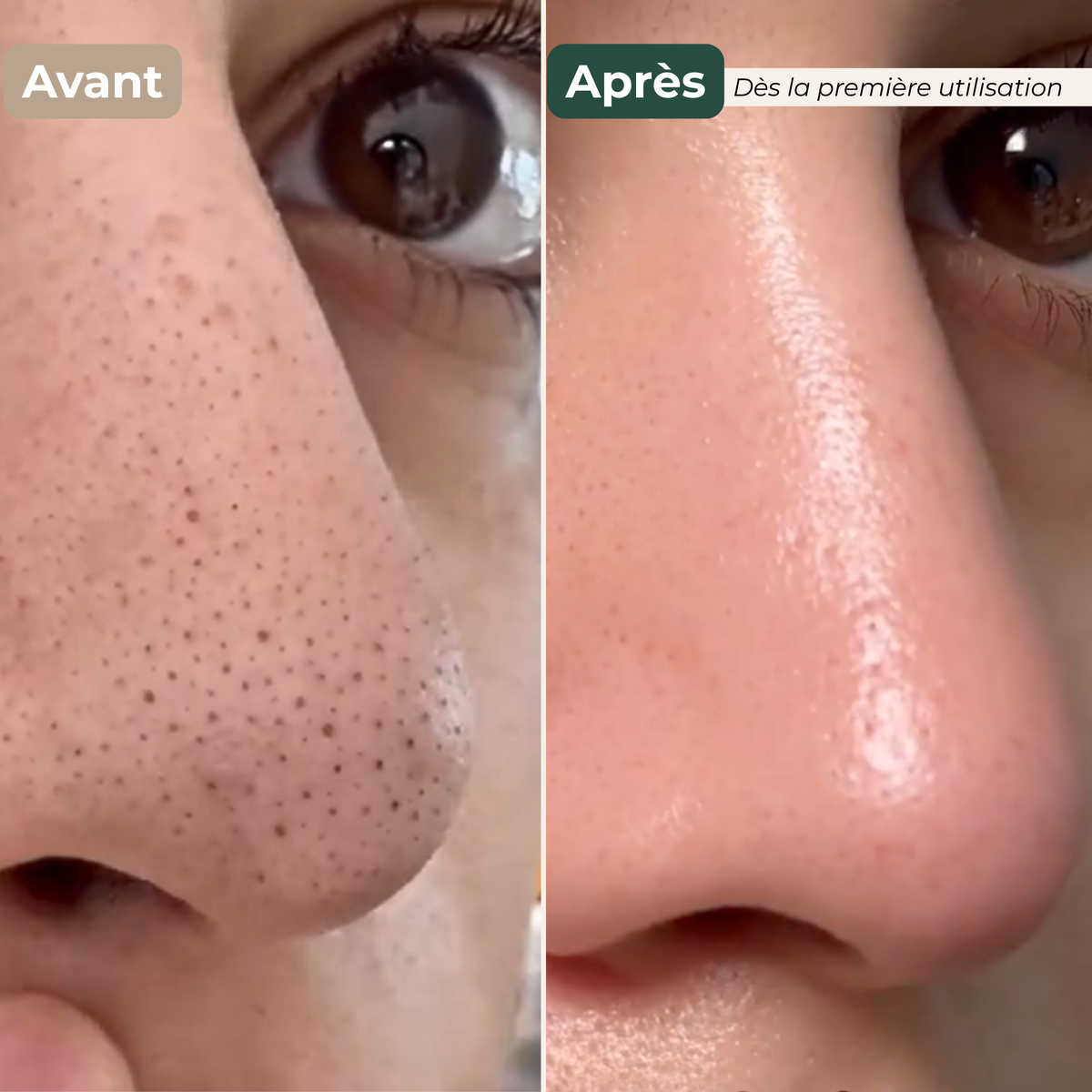 Patchs Purifiants Nez  Anti-Pores