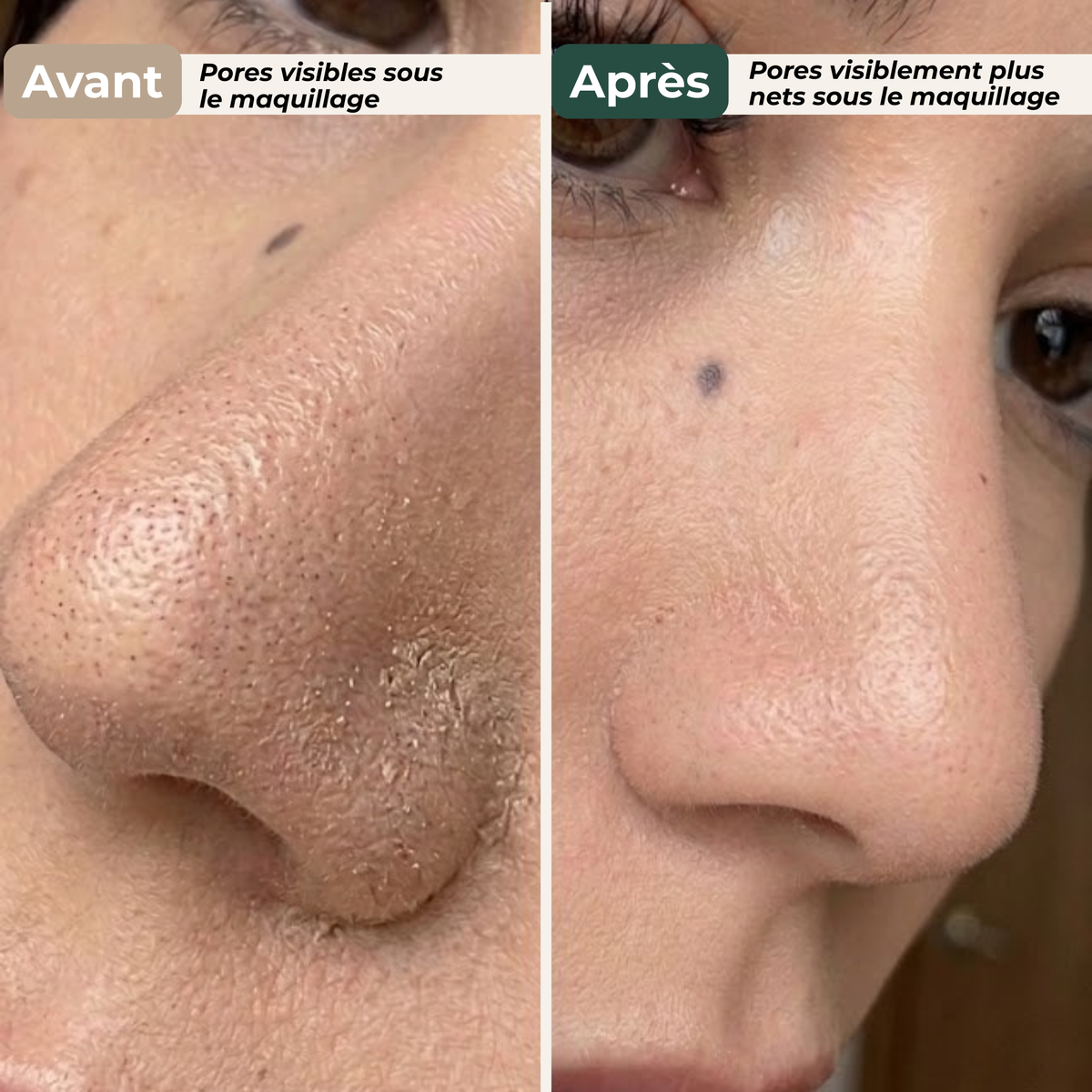 Patchs Purifiants Nez  Anti-Pores